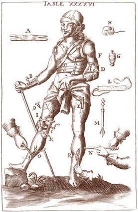 L'Arcenal de chirurgie, Nouvellement traduit en François par un célèbre médecin. Augmenté de plusieurs réflexions sur la théorie, et de quantité de remèdes ... avec un traité des Accouchemens, naturels & contre nature: la Description de deux monstres humains & une Dissertation sur un autre Monstre, né à Lyon le 28 de septembre 1702. Enrichi de 50 figures...