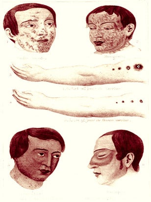 Item #13693 Traité des maladies vénériennes, des affections de la peau et des organes...
