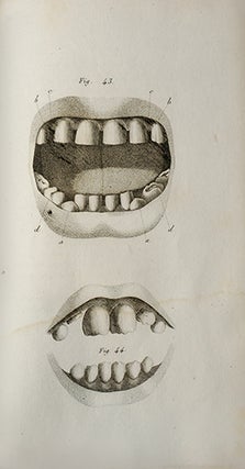 Traité de la seconde dentition, et méthode naturelle de la diriger; suivis d'un aperçu de séméiotique buccale.