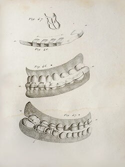 Traité de la seconde dentition, et méthode naturelle de la diriger; suivis d'un aperçu de séméiotique buccale.