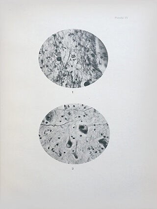 Système nerveux central : Coupes histologiques photographiées