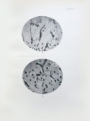 Système nerveux central : Coupes histologiques photographiées
