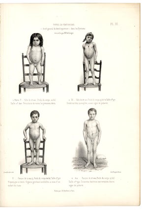 Traité des dégénérescences physiques, intellectuelles et morales de l'espèce humaine, et des causes qui produisent ces variétés maladives.