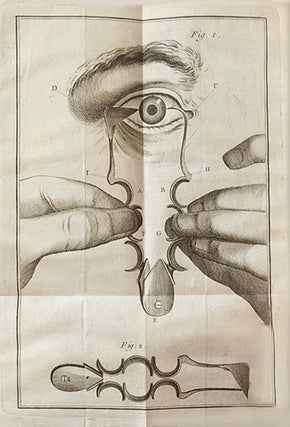Traité sur les maladies des yeux, dans lequel l'auteur après avoir exposé les différentes méthodes de faire l'opération de la cataracte, propose un instrument nouveau qui fixe l'oeil tout à la fois & opère la section de la cornée.