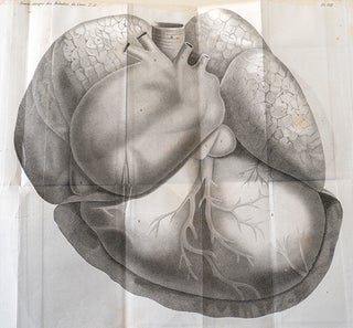 Traité clinique des maladies du coeur, précédé de recherches nouvelles sur l'anatomie et la physiologie de cet organe.