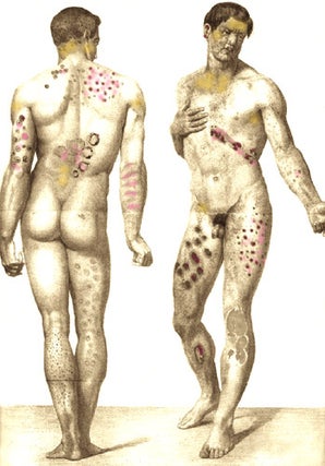 Item #4313 Abrégé pratique des maladies de la peau, d'après les auteurs les plus estimés, et...